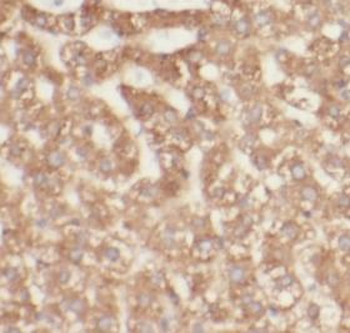 TCTN2 Rabbit Polyclonal Antibody