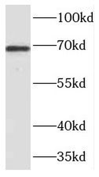 TDP1 Rabbit Polyclonal Antibody