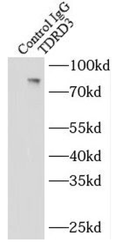 TDRD3 Rabbit Polyclonal Antibody