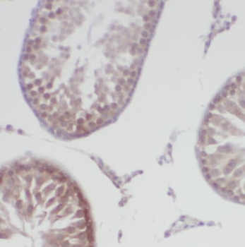 TEKT1 Rabbit Polyclonal Antibody