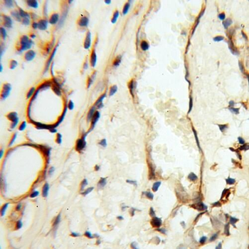 TEKT2 Rabbit Polyclonal Antibody
