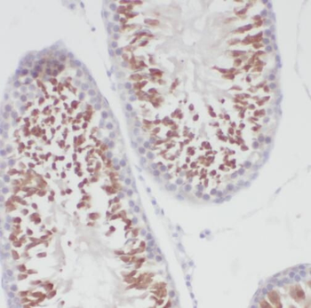 TEKT3 Rabbit Polyclonal Antibody