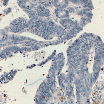 TESC Rabbit Polyclonal Antibody