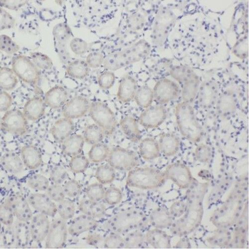 TEX12 Rabbit Polyclonal Antibody