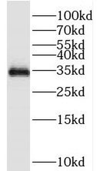 TEX264 Antibody