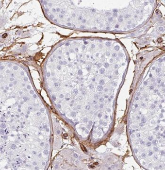 TEX264 Rabbit Polyclonal Antibody
