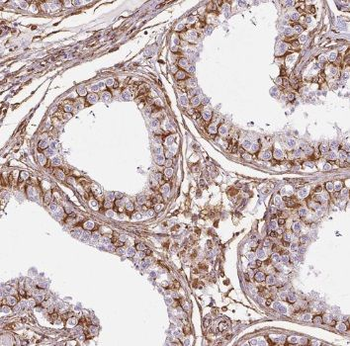 TEX38 Rabbit Polyclonal Antibody