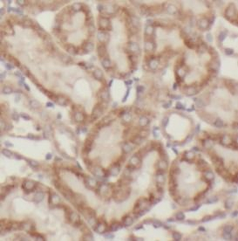 TFAM Rabbit Polyclonal Antibody