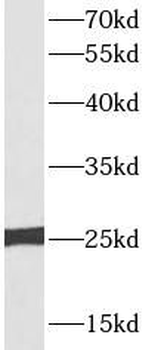 TFAM Rabbit Polyclonal Antibody