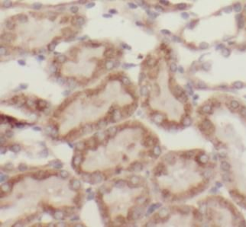 TFAM Rabbit Polyclonal Antibody