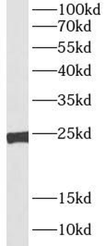 TFAM Rabbit Polyclonal Antibody