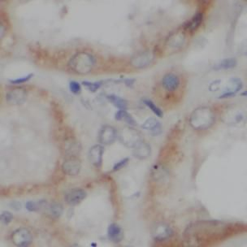 TFAM Rabbit Polyclonal Antibody