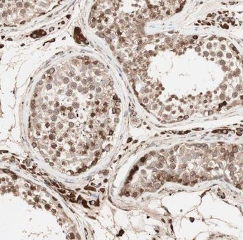 TFAP2C Rabbit Polyclonal Antibody