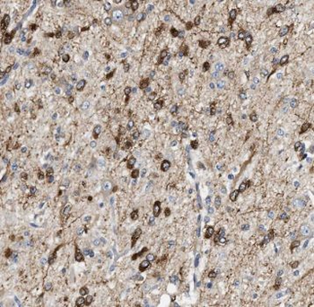 TFAP4 Rabbit Polyclonal Antibody