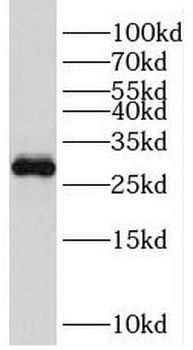 TFPT Antibody