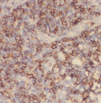 TFPT Rabbit Polyclonal Antibody