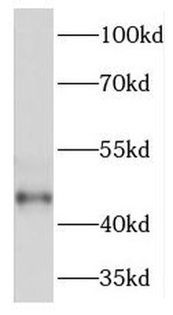TGDS Rabbit Polyclonal Antibody