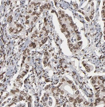 TGDS Rabbit Polyclonal Antibody