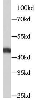TGFB1 Rabbit Polyclonal Antibody