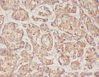 TGFB1 Rabbit Polyclonal Antibody