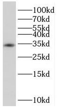 TGIF2LX Antibody