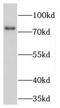 TGM2 Rabbit Polyclonal Antibody