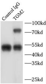 TGM2 Rabbit Polyclonal Antibody