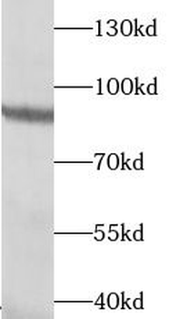 TGM5 Antibody