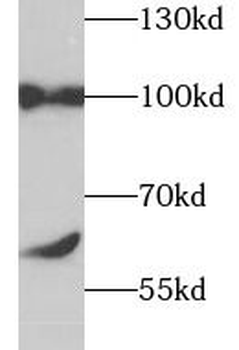 TGS1 Antibody
