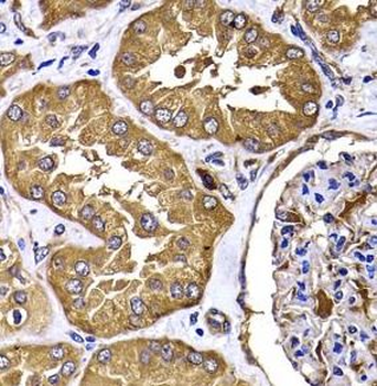 TGS1 Rabbit Polyclonal Antibody