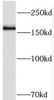 THADA Antibody
