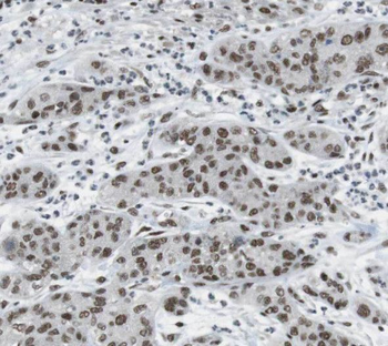 THADA Rabbit Polyclonal Antibody