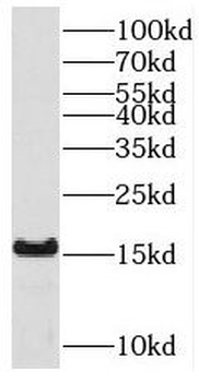 ACOT13 Rabbit Polyclonal Antibody
