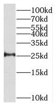 THEM4 Antibody