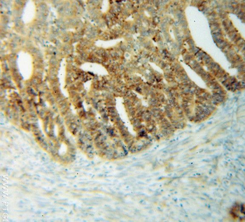 THEM4 Rabbit Polyclonal Antibody