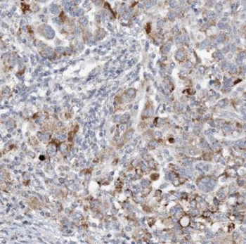 THG1L Antibody