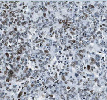 THOC6 Rabbit Polyclonal Antibody
