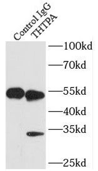 THTPA Rabbit Polyclonal Antibody