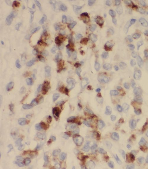 THTPA Rabbit Polyclonal Antibody