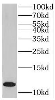 MYO18A Antibody