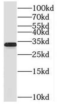 TICAM2 Antibody