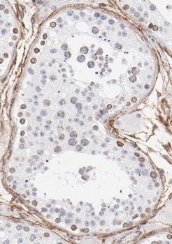 TICAM2 Rabbit Polyclonal Antibody