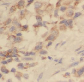 TEK Rabbit Polyclonal Antibody