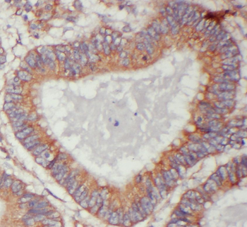 TIMM10 Rabbit Polyclonal Antibody