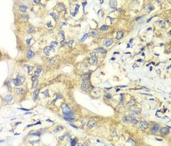 TIMM17A Rabbit Polyclonal Antibody