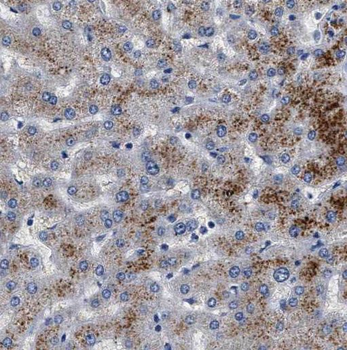 TIMM22 Rabbit Polyclonal Antibody
