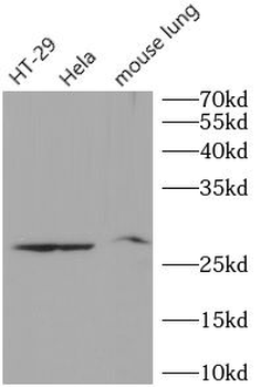 TIMP1 Rabbit Polyclonal Antibody