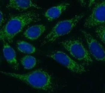 TIMP1 Rabbit Polyclonal Antibody