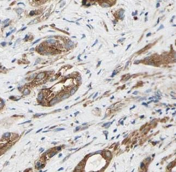 TIMP1 Rabbit Polyclonal Antibody