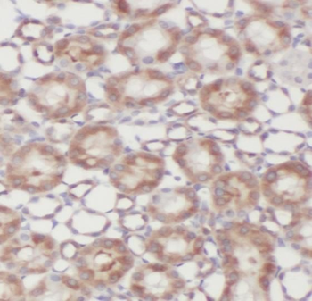 TIMP2 Rabbit Polyclonal Antibody